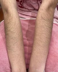 -薇兰专业脱毛连锁机构