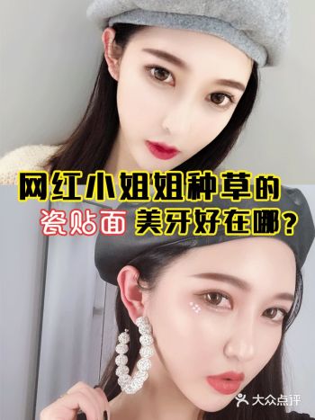 网红小姐姐种草的瓷贴面美牙好在哪?