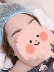 -莲姿娜半永久纹眉皮肤管理
