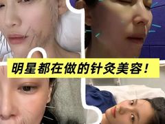 -名医堂永康中医·推拿正骨·针灸·艾灸