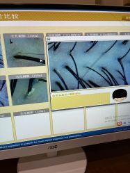 -丝客富脱发养发头皮馆