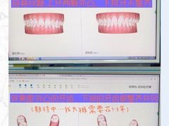 -爱雅仕口腔·数字化矫正中心(国贸门诊)
