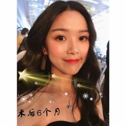 -大麦微针植发全国连锁