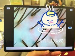 -润复丝·泽发防脱头皮管理