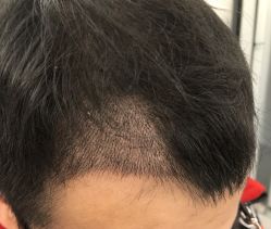 -熙朵美学植发·连锁品牌