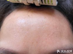 体验前-恒博天姿医疗美容