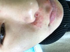 -大连市皮肤病医院