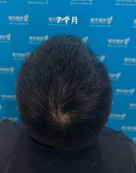 -雍禾植发