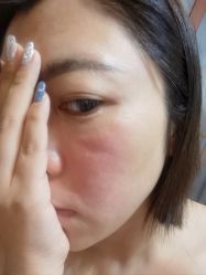 体验后-亿美医疗美容·半岛大超炮官方授权店