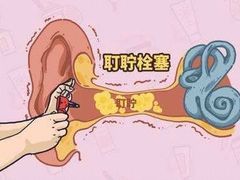 -AudioNova 海之声助听器峰力助听器索诺瓦自营店(北京店)