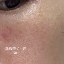 体验后-媛音医美