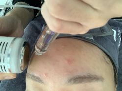 -첫번째 初见美学中心