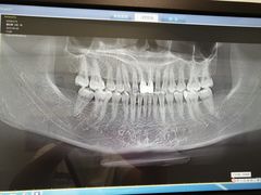 -Dr.Z dental仁康种植矫正中心