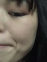 -Dr.ACNE痘院长祛痘皮肤管理连锁