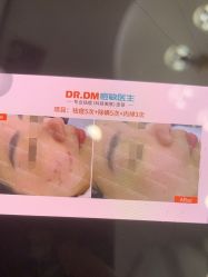 -痘敏医生专业祛痘·肌肤修复连锁