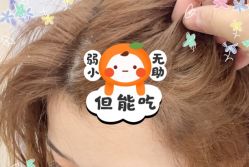 -大麦微针植发全国连锁