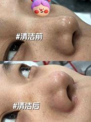 -苗方清颜专业祛痘·皮肤管理
