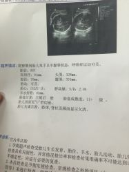 -丽水市妇幼保健院
