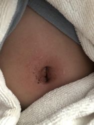 -豆乐园健康调理·小儿推拿