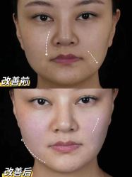 -Yestar重庆艺星医疗美容医院