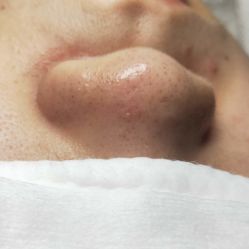 -苑苑vbeauty科技美容SPA