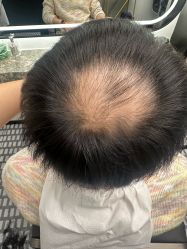 -唐风采假发补发定制
