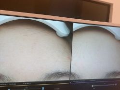-苑苑vbeauty科技美容SPA