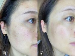 -Cream88颜皮肤管理中心