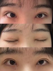 -JustHer宁波珈禾医疗美容医院