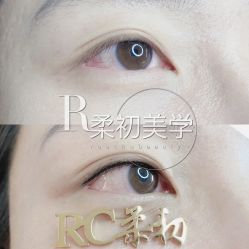 -RC半永久纹眉纹发际线