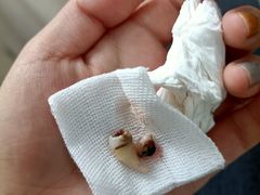 -Dr.Z dental仁康种植矫正中心