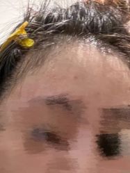 体验前-深圳美莱医疗美容医院