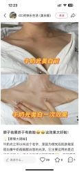 点击看大图 -YESIDO椰岛美容