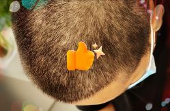 -大麦微针植发全国连锁