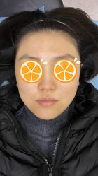 点击看大图 体验前-和颜一美轻医美连锁