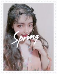 点击看大图 体验后-大麦微针植发全国连锁