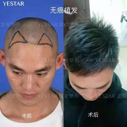 -Yestar艺星医疗美容医院