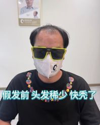 -唐风采假发补发定制