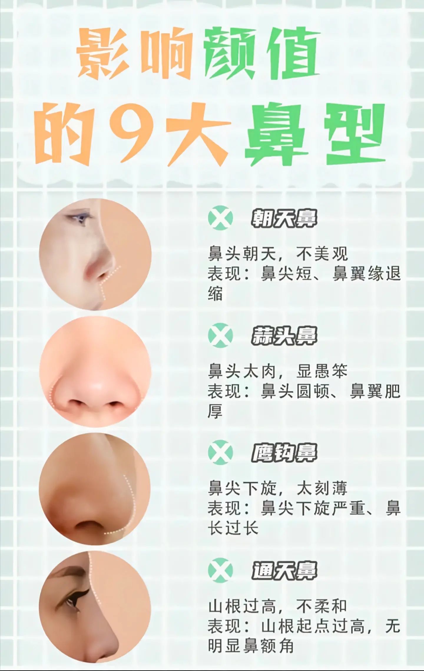 影响颜值的九大鼻型你知道吗?