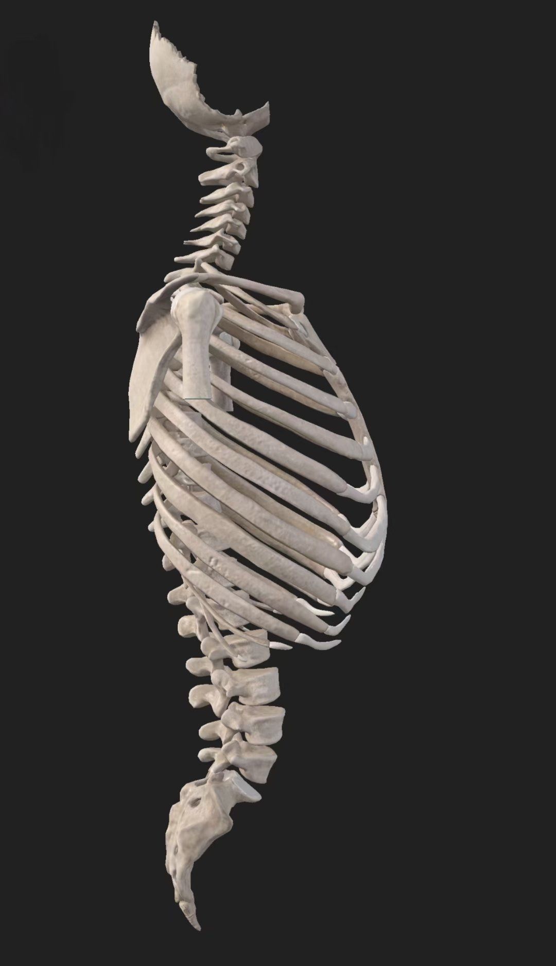 成长轨迹:骨骼x光对比