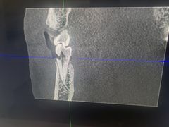 -Dr.Z dental仁康种植矫正中心