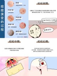 -靓芙泉·0感专研祛痘