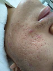 -痘博士北京·全国连锁祛痘机构