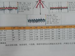 -爱康国宾体检中心(顺平分院)
