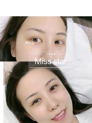 -MISS STAR·半永久纹眉·发际线·美瞳线