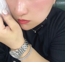 体验后-郡艺医疗美容·微整·眼鼻吸脂