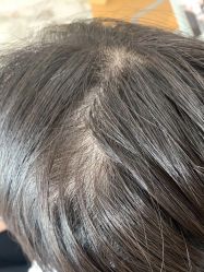 -熙朵美学植发·连锁品牌