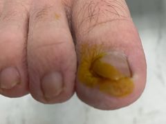 -世龙世家手足健康护理连锁(福田梅林路润裕花园店)