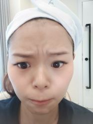 体验前-海涛医疗美容·面部抗衰·注射美鼻