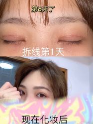 点击看大图 -深圳艺星医疗美容医院